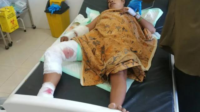 Mucize kurtuluş! 90 dakika boyunca timsahın ağzında mahsur kaldı... “Hâlâ görüntüsü gözümün önünde”