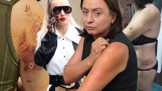 Pitbull hastanelik etti! Saldırı anında sahibi öylece bekledi... “Kahkahalarla gülüyordu”