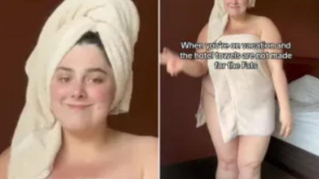 Sosyal medyadan otel havlularına isyan etti! “Büyük bedenim ve bana küçük geliyorlar”