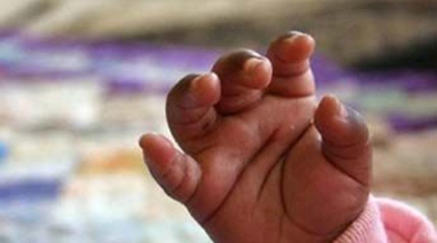 İki başlı &ccedil;ocuk d&uuml;nyaya geldi