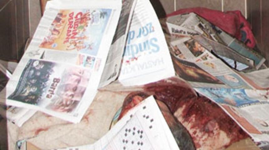 Parmakları olmayan iş&ccedil;inin feci &ouml;l&uuml;m&uuml;