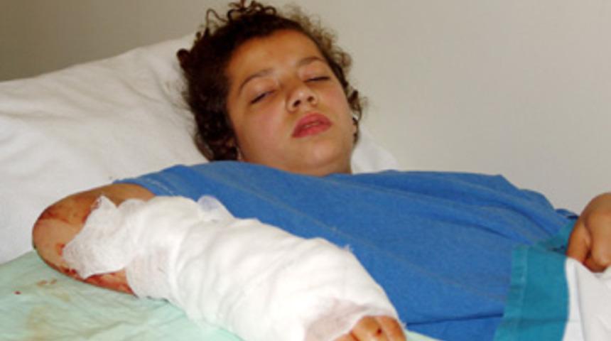 K&uuml;&ccedil;&uuml;k kızın asans&ouml;re sıkışan parmakları koptu