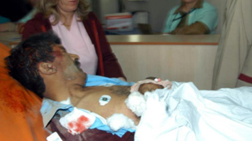 Makas g&ouml;revlisinin ayakları koptu