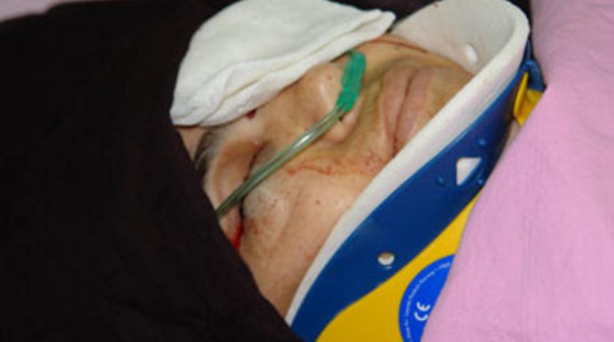 Karısını g&ouml;zlerinden vurdu