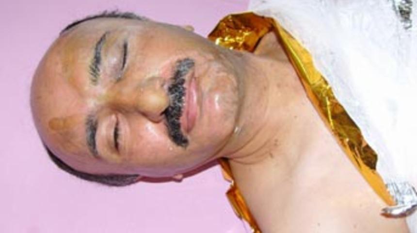 Kuyumcuya kezzaplı saldırı