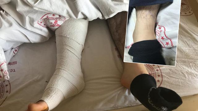 'İşaretleyip mürekkeple boyadı' Narkozun etkisi geçince büyük şok yaşadı! 'Yanlış ayağımdan ameliyat ettiler' iddiası