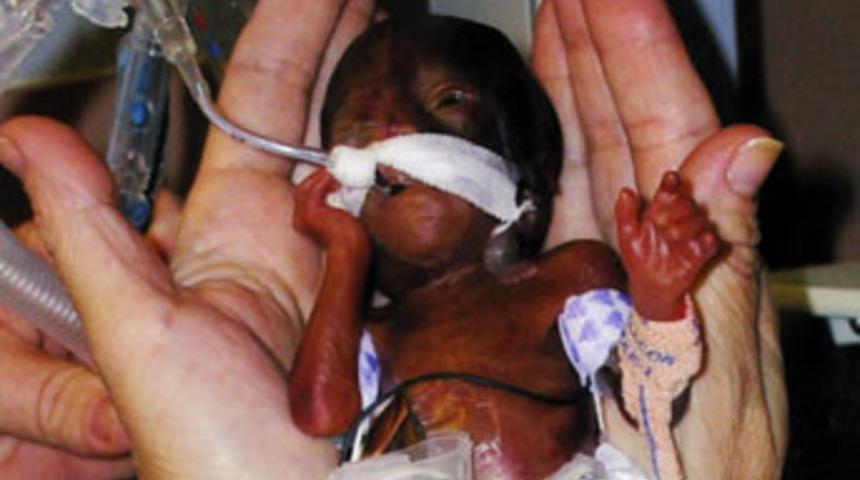 Mucize bebek taburcu edildi