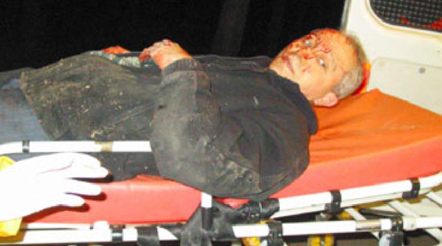 Taksimetre &ccedil;ok yazınca taksiciyi darp ettiler