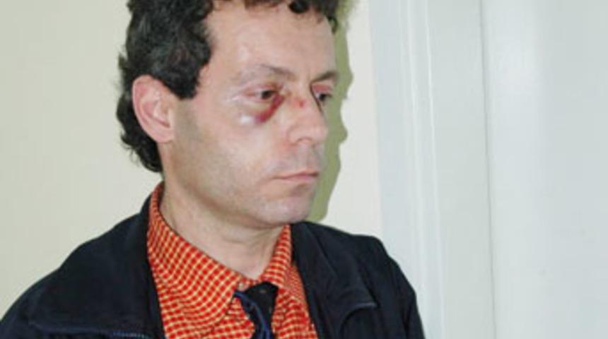 G&ouml;z&uuml;ne sprey sıkılan &ouml;ğretmen okulda darp edildi