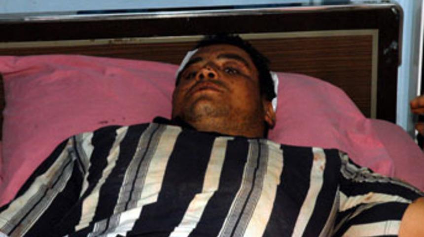 Akrabalar arasında silahlı &ccedil;atışma &ccedil;ıktı: 1 &ouml;l&uuml;