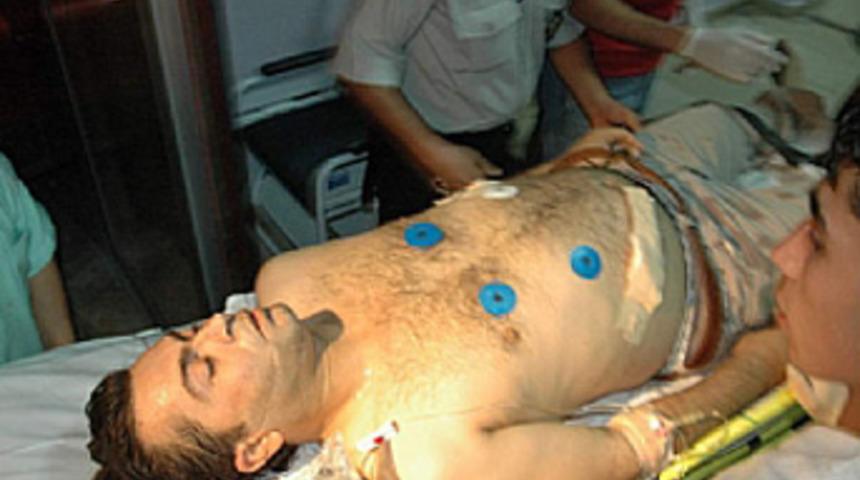 D&uuml;ğ&uuml;nde maganda kurşunu: 1 &ouml;l&uuml;, 1 yaralı
