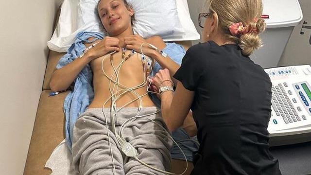 Lyme hastalığı ile mücadele ediyordu! Model Bella Hadid tedavi sürecinden paylaştı... 