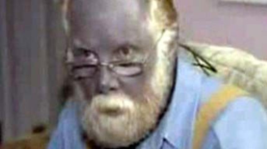 Şirin Baba gibi mavi oldu