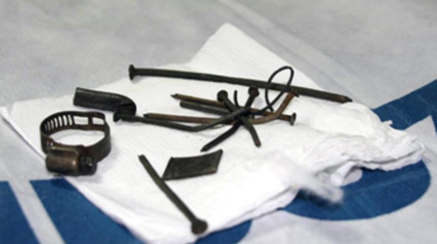 İnsanların midesinden &ccedil;ıkanlar şaşırtıyor