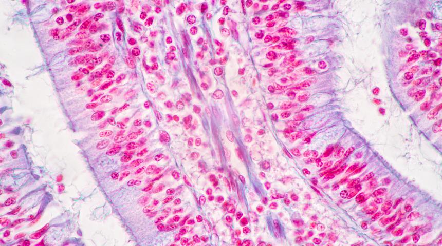 Yassı epitel nedir? İdrarda yassı epitel hücre yüksekliği ne demek?