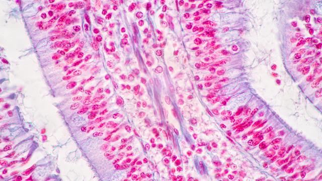 Yassı epitel nedir? İdrarda yassı epitel hücre yüksekliği ne demek?