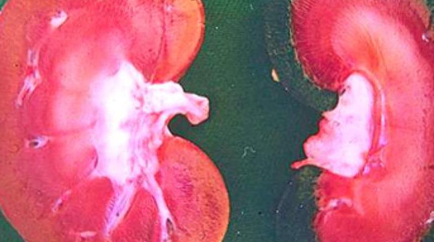 B&ouml;brek sağlığı i&ccedil;in idrar tutulmamalı