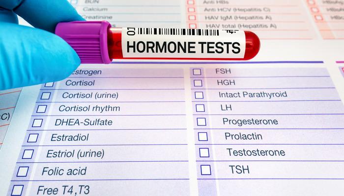 Hormon testi aç karnına mı yapılır?