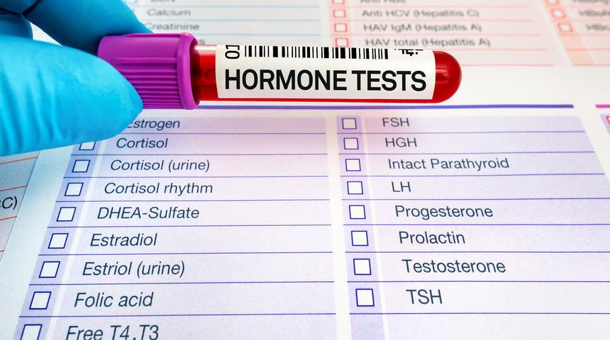 Hormon testi nasıl yapılır? Hormon testi nedir, sonuçları ne zaman belli olur?