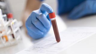 Hemoglobin yüksekliği neden olur? Hemoglobin (HGB) normal değerleri kaç olmalı?