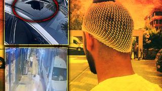 Başına alev almış piknik tüpü düştü! Araçla seyir halindeyken hayatının dehşetini yaşadı: Söndüremeyince balkondan aşağı atmışlar