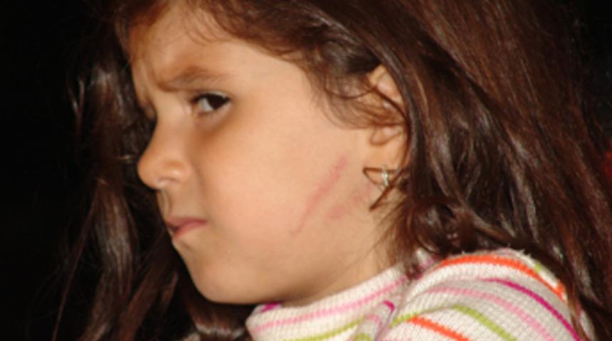 Kadın diş hekimi 3 yaşındaki &ccedil;ocuğu darp mı etti?