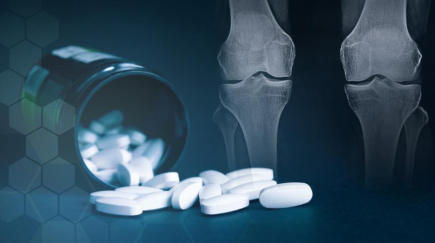 Glukozamin faydaları: Glukozamin ne işe yarar?