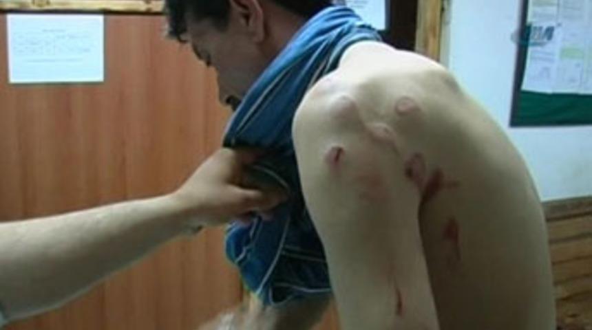 Gen&ccedil; kadın, boşandığı kocasını hastanelik etti