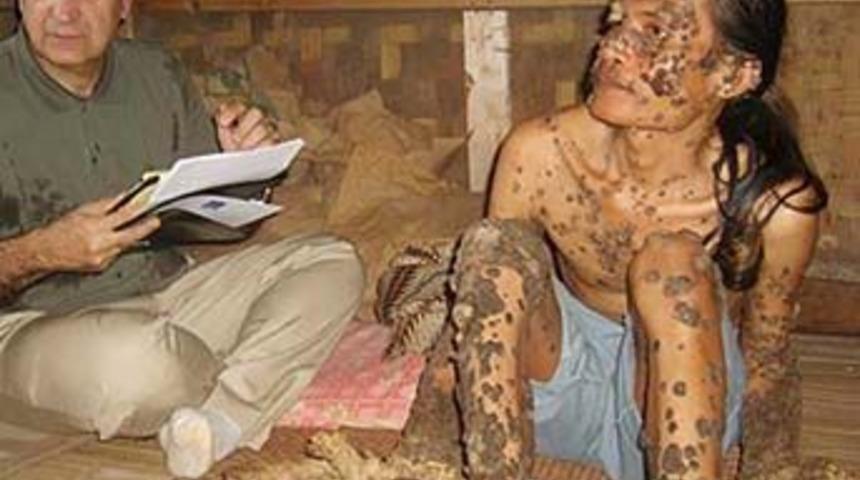 "Ağa&ccedil; adamların" tedavisine izin yok