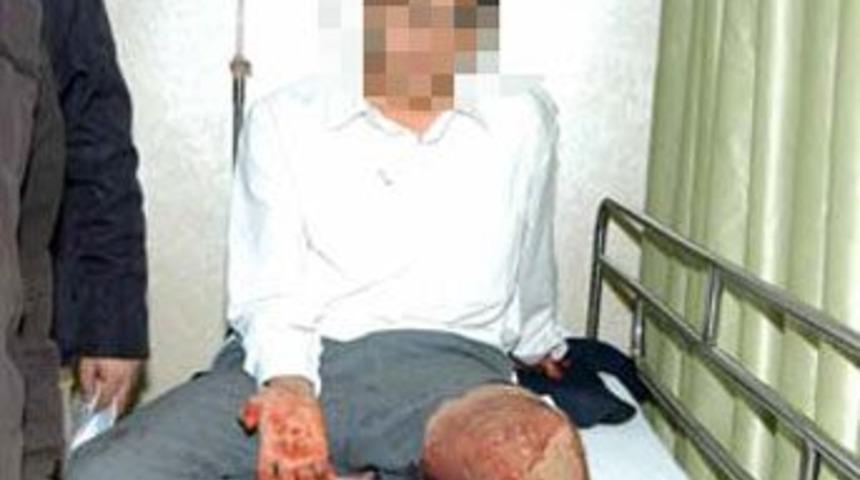 İlkokulda 'fal&ccedil;atalı' kavga