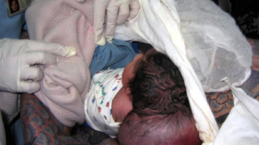 Yeni doğan bebekte 1 kiloluk su torbası