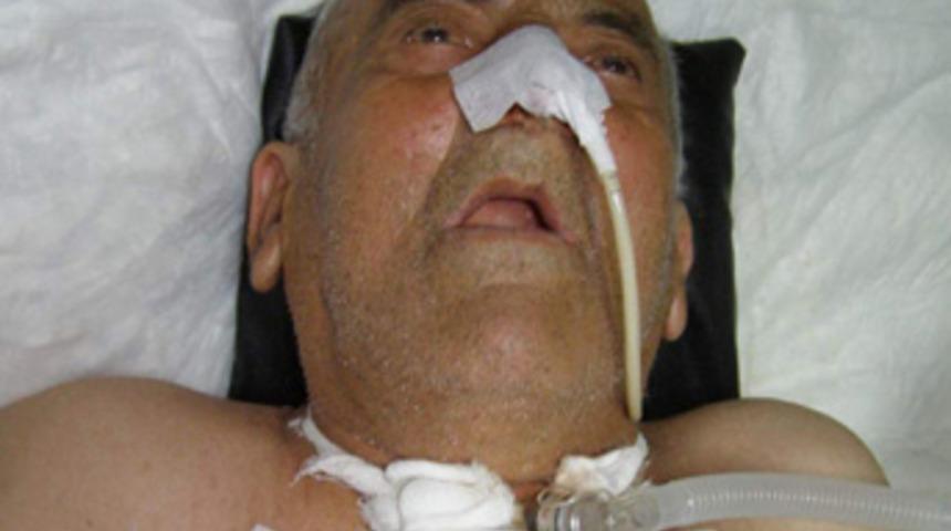 Nefes borusundaki lades kemiğiyle 20 yıl yaşadı