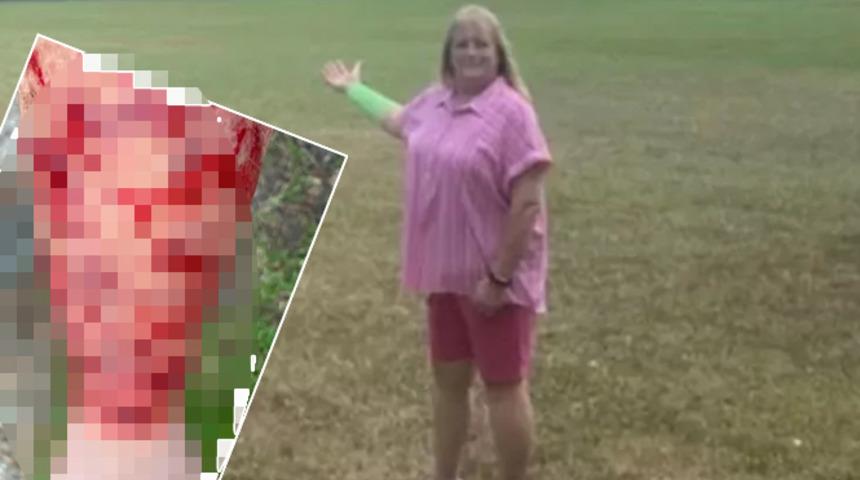 Bu kadarını kimse beklemiyordu! Başına gelmeyen kalmadı... Gökyüzünden düşen yılan yırtıcı kuş aynı anda saldırdı