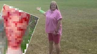 Bu kadarını kimse beklemiyordu! Başına gelmeyen kalmadı... Gökyüzünden düşen yılan yırtıcı kuş aynı anda saldırdı