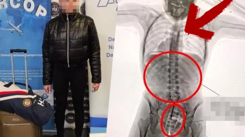 Havalimanında kıskıvrak yakalandı! Milyonlarca liralık yasa dışı maddeyi cinsel organında saklamış