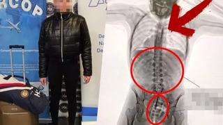 Havalimanında kıskıvrak yakalandı! Milyonlarca liralık yasa dışı maddeyi cinsel organında saklamış