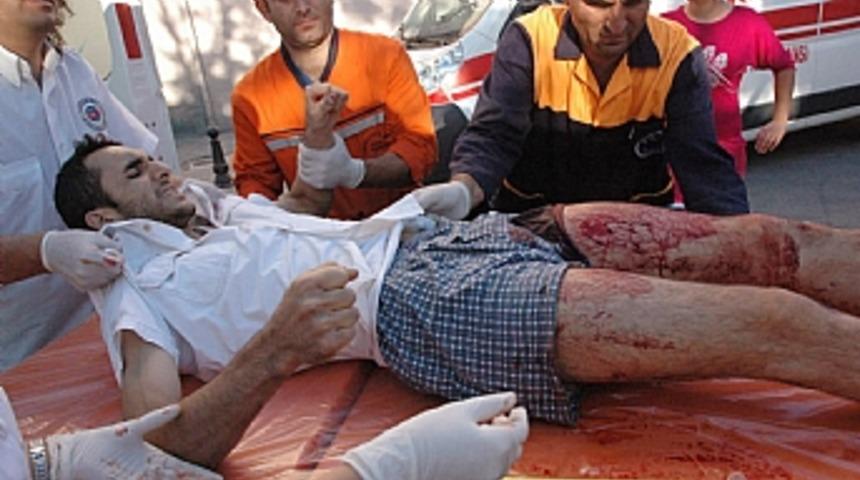 Enişteden kayınbiradere bı&ccedil;aklı saldırı