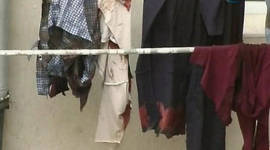 156 kere bı&ccedil;akladılar