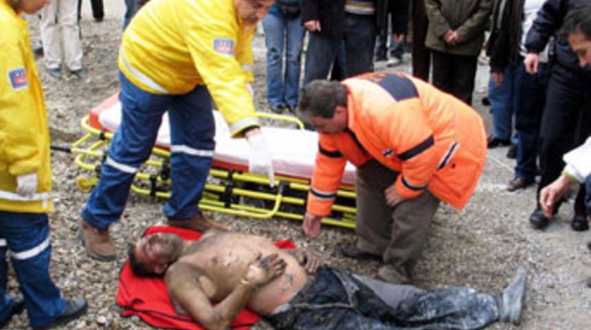 Sevdiği kız i&ccedil;in kendisini yaktı