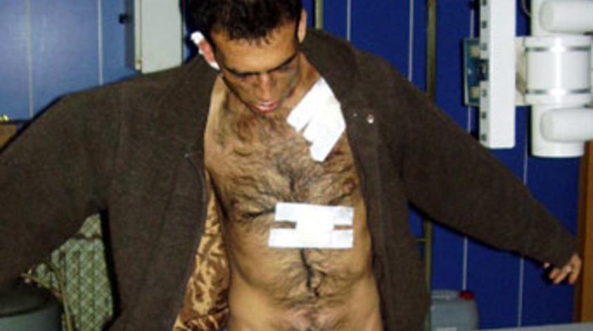 Sevdiği kızı ka&ccedil;ırmaya kalkışınca bı&ccedil;aklandı