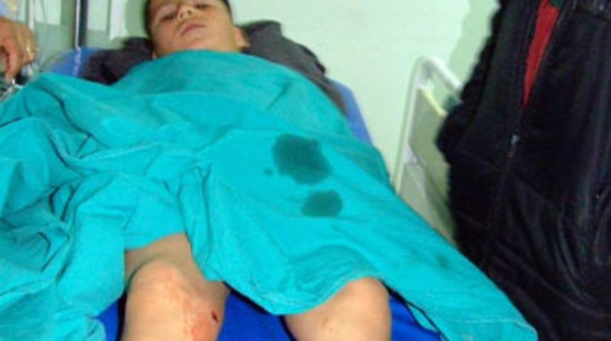 Pompalı t&uuml;fekle dehşet: 1 &ouml;l&uuml; 4 yaralı