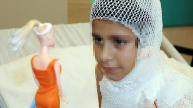 Sosyal medyada görüp evde denedi, ölümden döndü! 'Ben yandım başkası yanmasın'