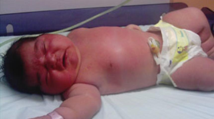 6 kiloluk bebek ilgi odağı oldu