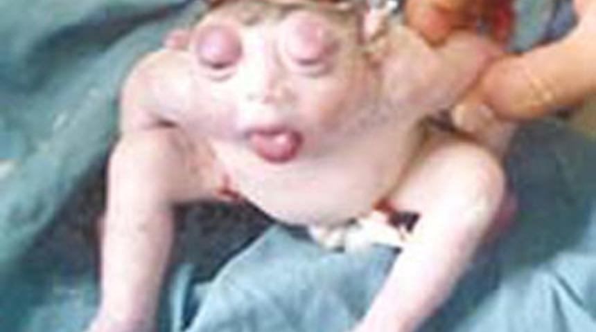 İşte Mısır'da doğan kurbağa bebek