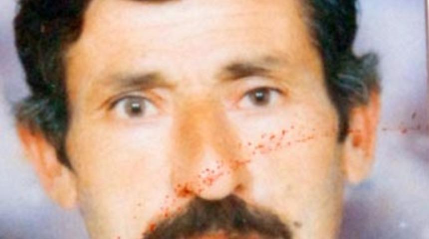 Protez dişini yuttu, hastanede &ouml;ld&uuml;