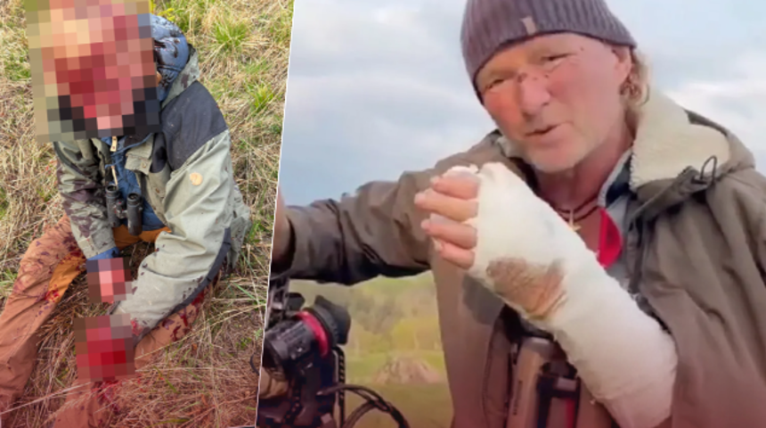 Dehşete düşüren saldırıdan mucizevi bir şekilde kurtuldu! Kafa derisi yüzüldü, kaburgaları ezildi... “Ne yapmam gerektiğini biliyordum”
