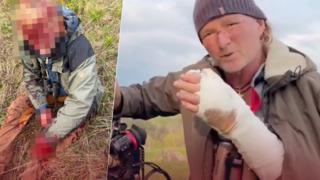 Dehşete düşüren saldırıdan mucizevi bir şekilde kurtuldu! Kafa derisi yüzüldü, kaburgaları ezildi... “Ne yapmam gerektiğini biliyordum”