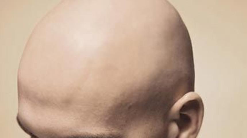 "Yanlış sa&ccedil; ekimi, binlerce '&ccedil;im adam' yarattı"