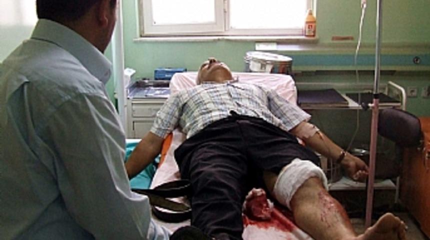 Alışverişe giderken bı&ccedil;akla yaralandı