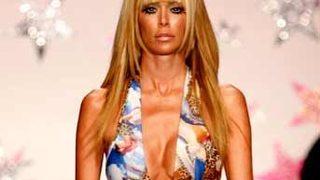 Zayıflama ameliyatları kansere karşı koruyucu